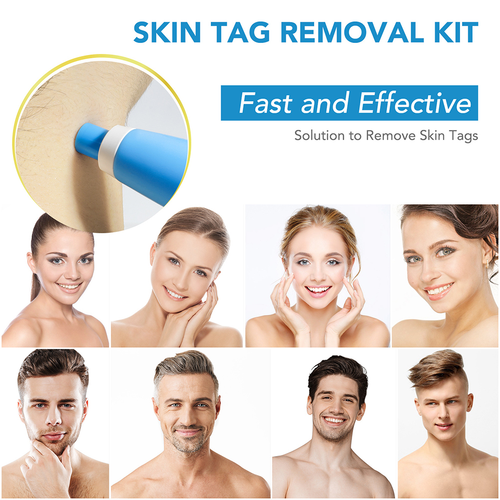 2-IN-1 Auto Skin Tag Removal K - Home Improvement Kit のレビューと価格